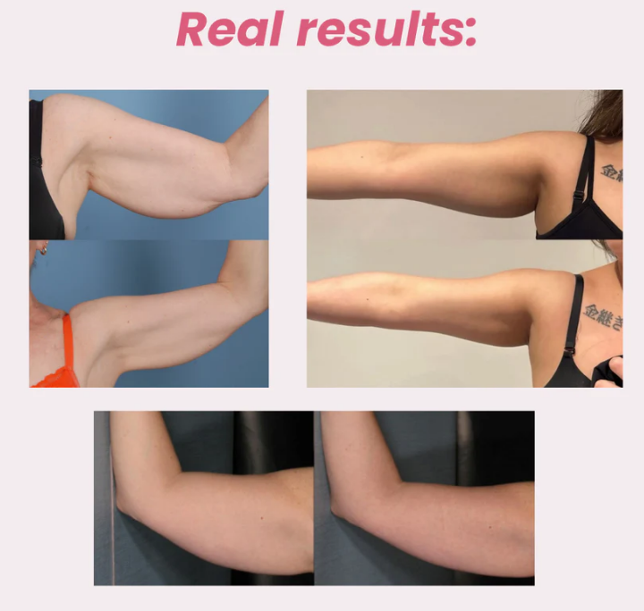 Red Light Therapy Arm Sleeve