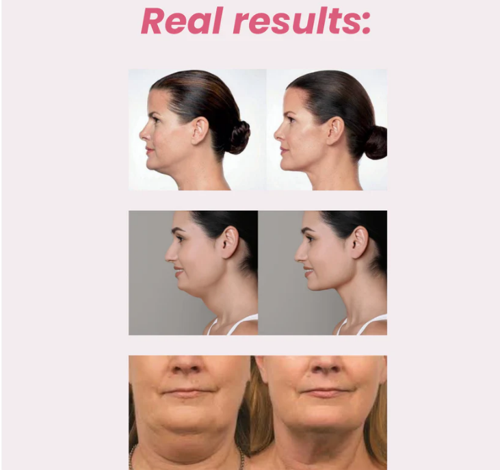 Red Light Therapy Neck Sleeve